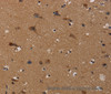 Immunohistochemistry of paraffin-embedded Human brain using TP53INP1 Polyclonal Antibody at dilution of 1:50