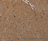 Immunohistochemistry of paraffin-embedded Human brain  using IVL Polyclonal Antibody at dilution of 1:50