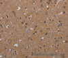 Immunohistochemistry of paraffin-embedded Human brain  tissue using PDGFC Polyclonal Antibody at dilution 1:40