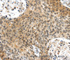 Immunohistochemistry of paraffin-embedded Human brain tissue using PLIN3 Polyclonal Antibody at dilution 1:40