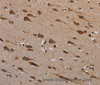 Immunohistochemistry of paraffin-embedded Human brain tissue using PLXNB1 Polyclonal Antibody at dilution 1:40