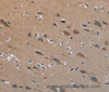 Immunohistochemistry of paraffin-embedded Human brain tissue using PLXND1 Polyclonal Antibody at dilution 1:40