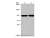 Western Blot analysis of Hela and A431 cell using PMS2 Polyclonal Antibody at dilution of 1:200