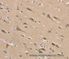 Immunohistochemistry of paraffin-embedded Human brain tissue using DLG2 Polyclonal Antibody at dilution 1:40