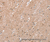 Immunohistochemistry of paraffin-embedded Human brain using RAB8A Polyclonal Antibody at dilution of 1:45
