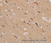 Immunohistochemistry of paraffin-embedded Human brain tissue using RAB6C Polyclonal Antibody at dilution 1:45