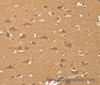 Immunohistochemistry of paraffin-embedded Human brain  using HIF1AN Polyclonal Antibody at dilution of 1:40