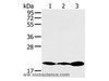 Western Blot analysis of Jurkat, 231 and K562 cell using RNF5 Polyclonal Antibody at dilution of 1:200