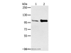Western Blot analysis of Mouse muscle and heart tissue using ACTN2 Polyclonal Antibody at dilution of 1:300