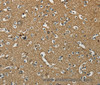 Immunohistochemistry of paraffin-embedded Human brain using NEMF Polyclonal Antibody at dilution of 1:30