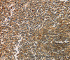 Immunohistochemistry of paraffin-embedded Human tonsil using SIGLEC15 Polyclonal Antibody at dilution of 1:35