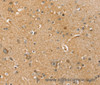 Immunohistochemistry of paraffin-embedded Human brain tissue using SLC41A2 Polyclonal Antibody at dilution 1:45