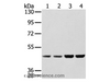 Western Blot analysis of Hela, Raji, 231 and K562 cell using SSB Polyclonal Antibody at dilution of 1:400