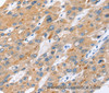 Immunohistochemistry of paraffin-embedded Human liver cancer tissue using ERVW-1 Polyclonal Antibody at dilution 1:45