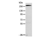 Western Blot analysis of Huvec cell using TLN1 Polyclonal Antibody at dilution of 1:200