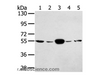 Western Blot analysis of Hela and K562 cell, Human fetal muscle tissue, A375 and hepg2 cell using TRIM35 Polyclonal Antibody at dilution of 1:400
