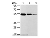 Western Blot analysis of Human thyroid and esophagus cancer, Human normal rectum tissue using TMPRSS11F Polyclonal Antibody at dilution of 1:500