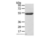 Western Blot analysis of Mouse plasma tissue  using AGPAT6  Polyclonal Antibody at dilution of 1:400
