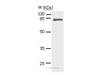 Western Blot analysis of Human fetal lung tissue using STAT5A Polyclonal Antibody at dilution of 1:450