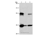 Western Blot analysis of Hela, K562 and Raji cell using BAG1 Polyclonal Antibody at dilution of 1:750