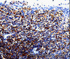 Immunohistochemistry of paraffin-embedded Human tosil tissue using IL10RA Polyclonal Antibody at dilution 1:60