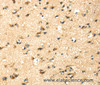 Immunohistochemistry of paraffin-embedded Human brain tissue using CK-17 Polyclonal Antibody at dilution 1:40