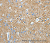 Immunohistochemistry of paraffin-embedded Human brain tissue using Amphiphysin II Polyclonal Antibody at dilution 1:30