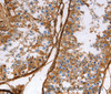 Immunohistochemistry of paraffin-embedded Human testis using Caldesmon Polyclonal Antibody at dilution of 1:40