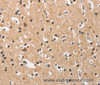 Immunohistochemistry of paraffin-embedded Human brain  using DKK3 Polyclonal Antibody at dilution of 1:50