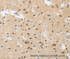 Immunohistochemistry of paraffin-embedded Human brain  tissue using FASTK Polyclonal Antibody at dilution 1:30