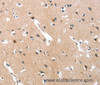 Immunohistochemistry of paraffin-embedded Human brain  tissue using GRB7 Polyclonal Antibody at dilution 1:40