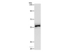 Western Blot analysis of Hela cell using HCK Polyclonal Antibody at dilution of 1:500