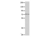 Western Blot analysis of Mouse eye tissue using MUC20 Polyclonal Antibody at dilution of 1:1400