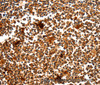 Immunohistochemistry of paraffin-embedded Human tonsil using MYOZ1 Polyclonal Antibody at dilution of 1:50