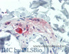 Immunohistochemistry of paraffin-embedded Colon, Submucosal Plexus tissue using TAC1 Polyclonal Antibody at dilution of 1:100(Elabscience® Product Detected by Lifespan).