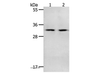 Western Blot analysis of Mouse spleen and intestinum crassum tissue using NME6 Polyclonal Antibody at dilution of 1:400