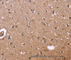 Immunohistochemistry of paraffin-embedded Human brain  tissue using S100A13 Polyclonal Antibody at dilution 1:40