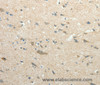 Immunohistochemistry of paraffin-embedded Human brain using SIRT3 Polyclonal Antibody at dilution of 1:30