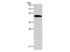 Western Blot analysis of Mouse liver tissue using SIRT7 Polyclonal Antibody at dilution of 1:600