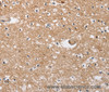 Immunohistochemistry of paraffin-embedded Human brain tissue using SOCS2 Polyclonal Antibody at dilution 1:40