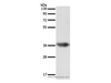 Western Blot analysis of Human liver cancer tissue using SULT1E1 Polyclonal Antibody at dilution of 1:500