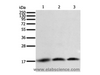 Western Blot analysis of A431, Jurkat and hela cell using Survivin Polyclonal Antibody at dilution of 1:400