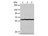 Western Blot analysis of Human liver cancer tissue, hela and Jurkat cell  using Factor IX Polyclonal Antibody at dilution of 1:400