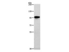 Western Blot analysis of Human brain malignant glioma tissue using TRAF3IP1 Polyclonal Antibody at dilution of 1:500