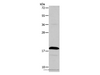 Western Blot analysis of Jurkat cell  using TSLP Polyclonal Antibody at dilution of 1:850