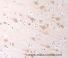 Immunohistochemistry of paraffin-embedded Human brain tissue using SCGB1A1 Polyclonal Antibody at dilution 1:60