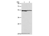 Western Blot analysis of A549 and Mouse eye tissue using ALDH3A1 Polyclonal Antibody at dilution of 1:750