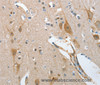 Immunohistochemistry of paraffin-embedded Human brain tissue using NOL3 Polyclonal Antibody at dilution 1:35