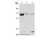 Western Blot analysis of Human fetal muscle, kidney and liver tissue using NAE1 Polyclonal Antibody at dilution of 1:500