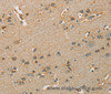 Immunohistochemistry of paraffin-embedded Human brain  tissue using ARSA Polyclonal Antibody at dilution 1:50